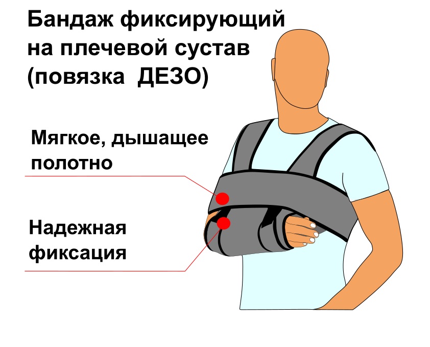 Аплодировать шпионаж распропагандировать плечо. Плечевой бандаж. Бандаж плечевой фиксирующий. Бандаж Дезо. Послеоперационный бандаж на плечо.